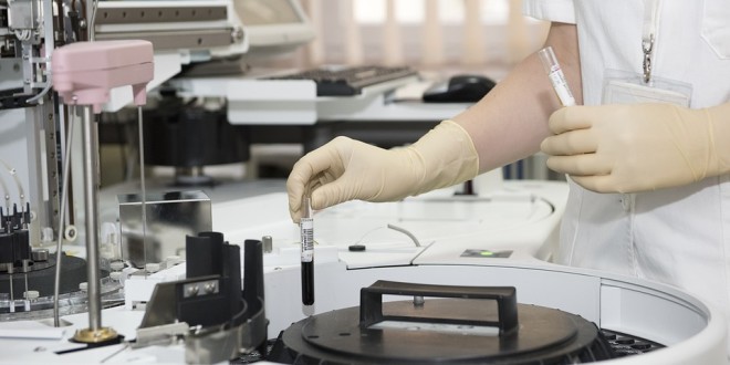 brca nedir, brca testi fiyatı, brca mutasyonu, brca testi ,brca geni, brca1, brca testi nerede yapılır, brca geni testi