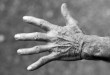 el titremesi için hangi doktora gidilir, el titremesi nasıl önlenir, el titremesi nasıl geçer, el titremesi nedenleri, el titremesi için ilaç, parkinson, el titremesi tedavisi, heyecandan el titremesi