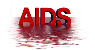 AIDS, HIV, ayids, Aids nasıl bulaşır