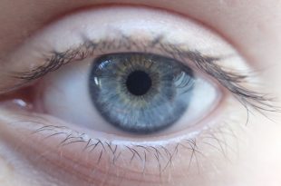 göz seğirmesi neden olur, göz seğirmesi nedenleri, göz seğirmesi tedavi, göz, bleferospazm, blefarit