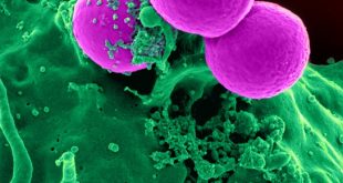 immunite, immun sistem